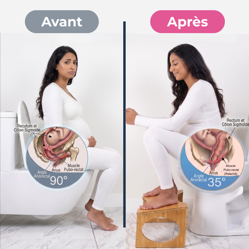 Posella, le tabouret physiologique